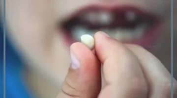 حلم السن المكسور