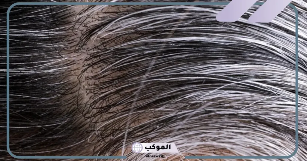 شيب الشعر في المنام للعزباء