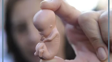 حلمت بالاجهاض