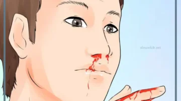 حلمت بخروج دم من انفي