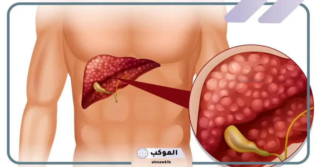 رؤية الكبد في المنام للمتزوجة