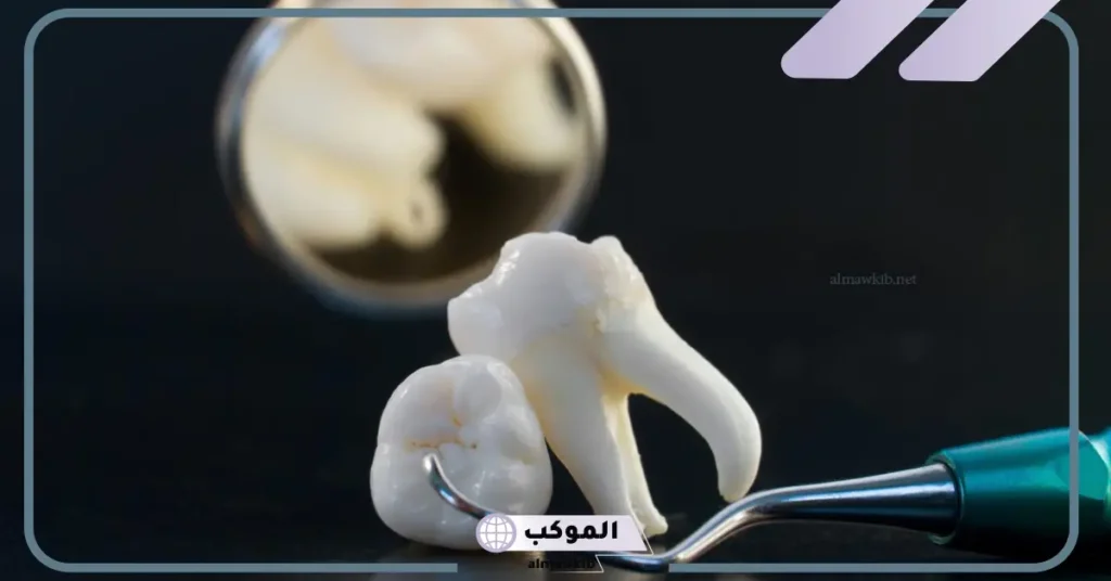 تفسير حلم خلع الضرس السفلي في المنام للمرأة لابن سيرين 5 خلع الضرس في المنام للمتزوجة