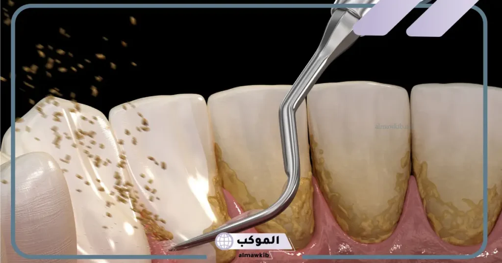 تفسير حلم تنظيف الاسنان للرجل في المنام لابن سيرين 5 تفسير حلم تنظيف الأسنان للعزباء