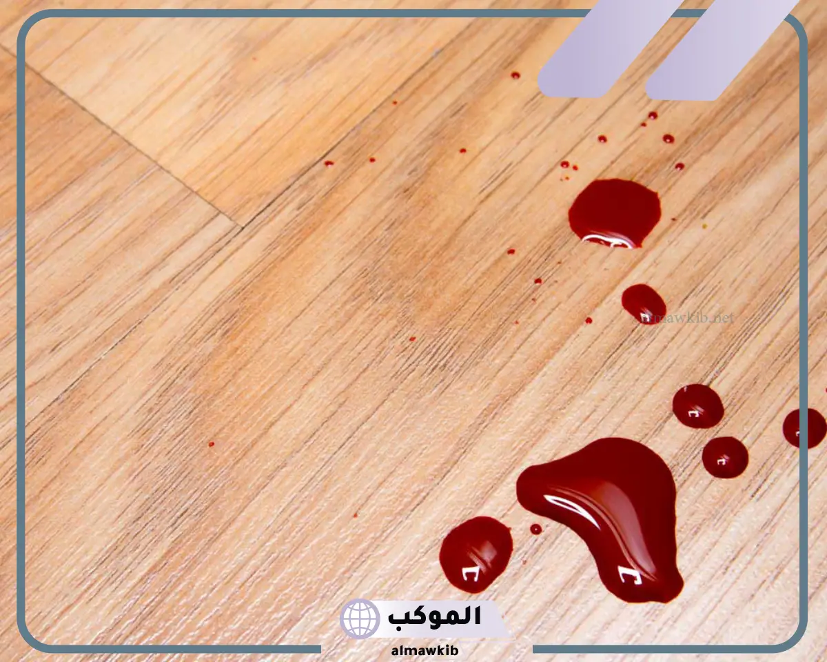 حلم استفراغ الدم