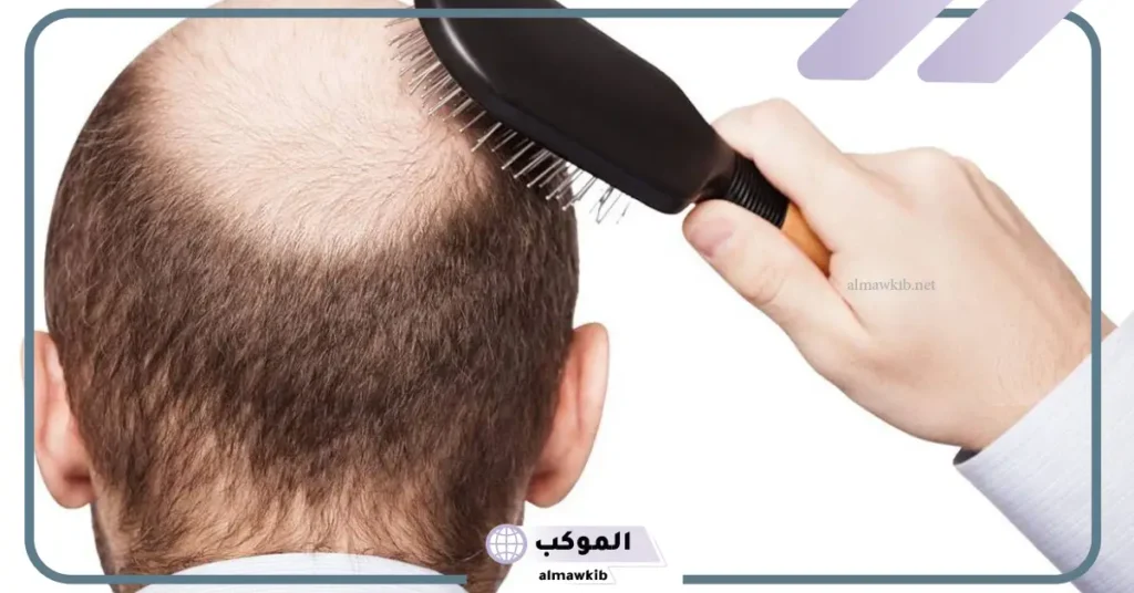 ما معنى تساقط الشعر في المنام للعزباء