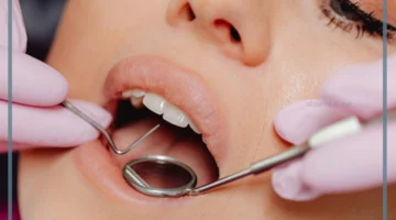 حلم سقوط سن