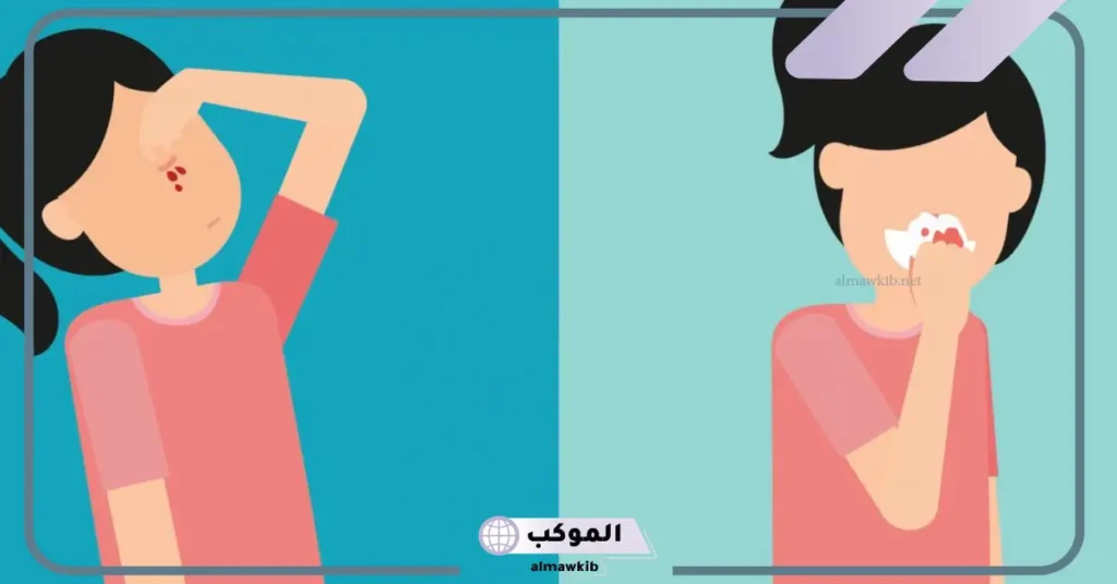 تفسير حلم الرعاف من الأنف للعزباء