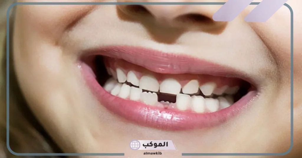 تفسير حلم سقوط الأسنان السفلي بدون دم 