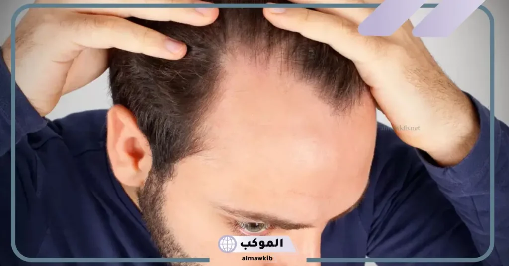 سقوط الشعر في المنام للمطلقة