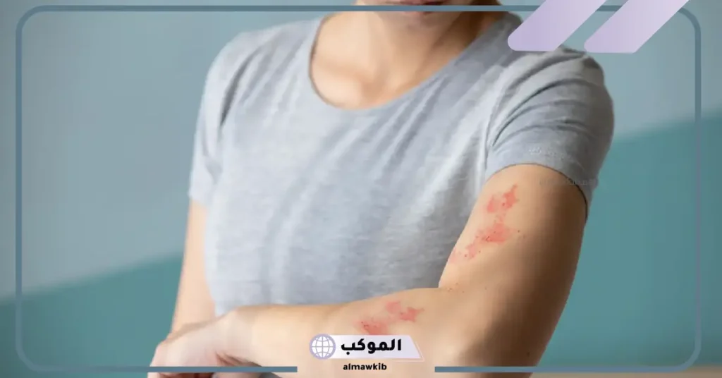 الحزام الناري والعلاقة الزوجية بالأسباب والعلاقة 6 هل الحزام الناري يسبب الوفاة