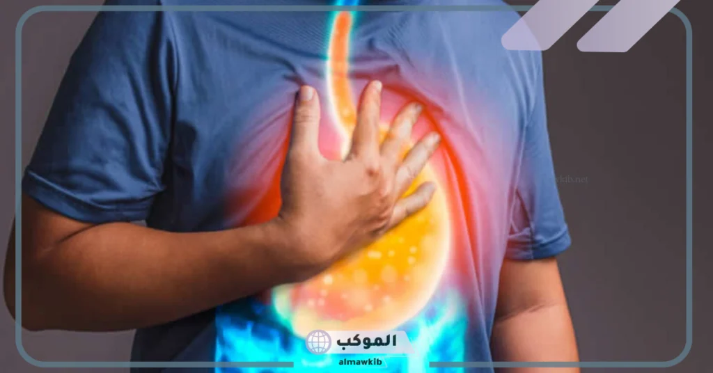 علاج ارتجاع المريء في المنزل 