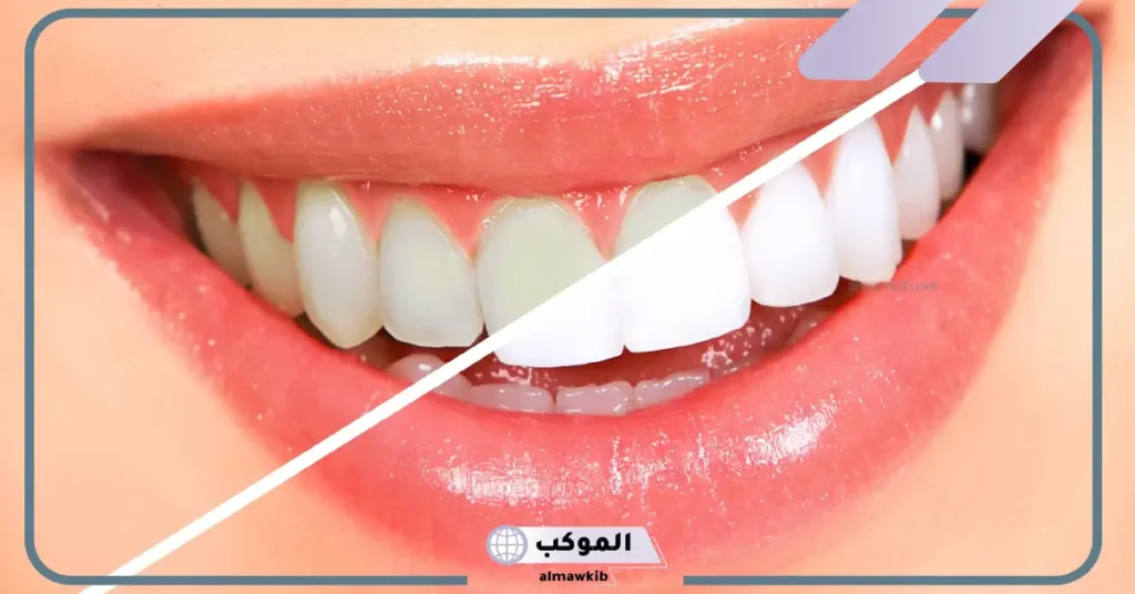 تفسير حلم الاسنان البيضاء النظيفة في المنام لابن سيرين للرجل والمرأة 5 ما تفسير حلم الأسنان لابن سيرين؟