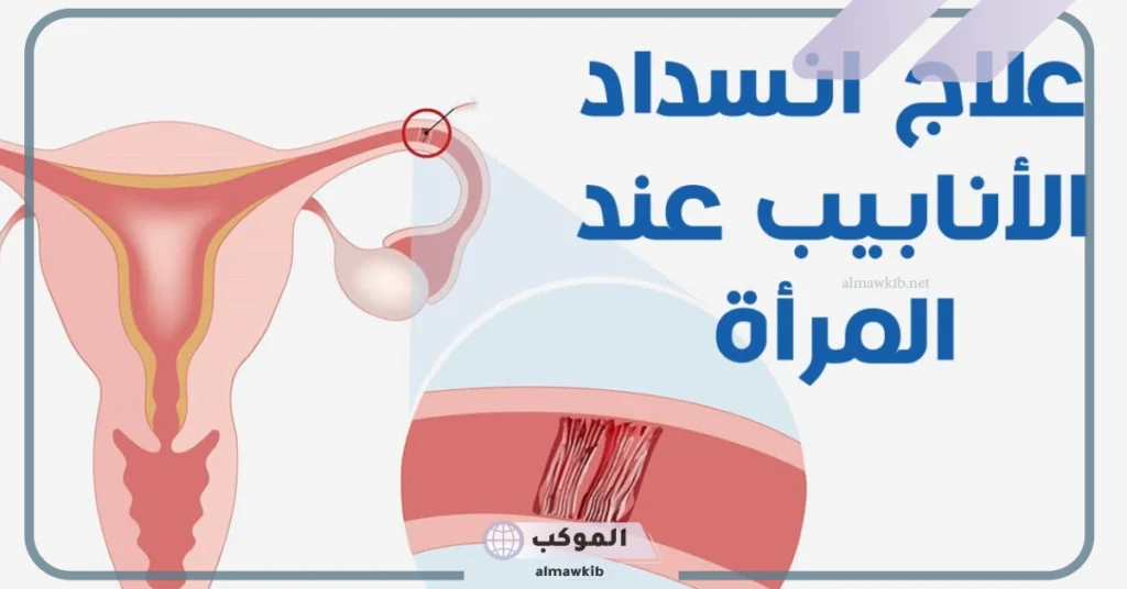 علاج انسداد الانابيب مجرب 