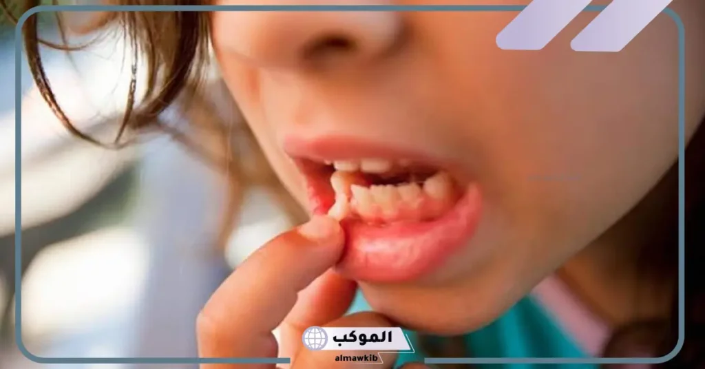 تفسير حلم تخلخل الاسنان في المنام للعزباء والمتزوجة والحامل 5 رؤيه تخلخل الاسنان في المنام