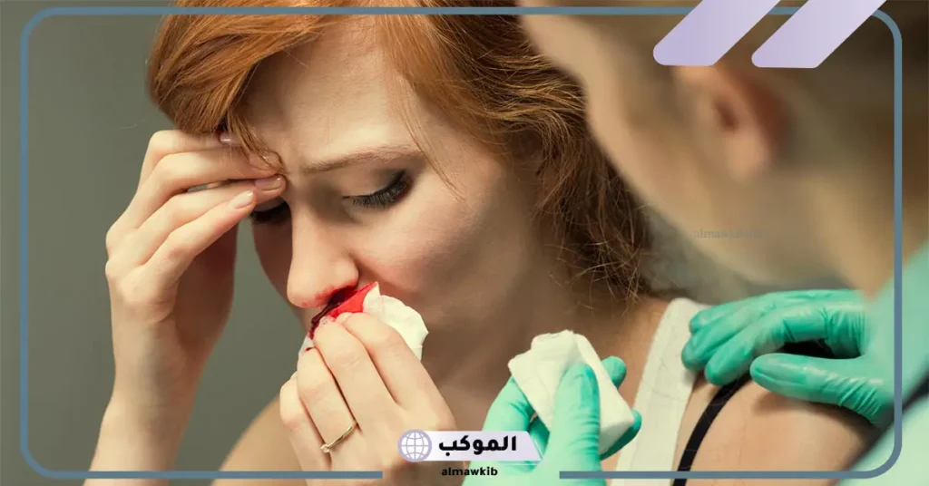 تفسير حلم نزيف الانف في المنام للرجل المتزوج والمرأة المطلقة والمتزوجة 5 نزيف الأنف في المنام للعزباء