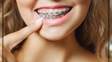 تقويم الأسنان في المنام