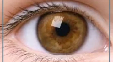 حلمت بالعين