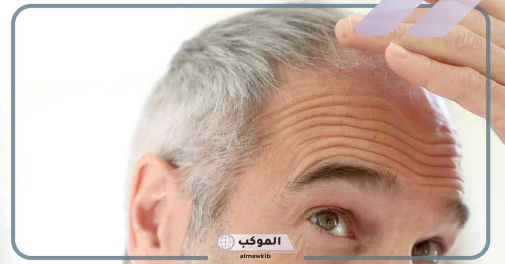 تفسير حلم رؤية الشيب في المنام للعزباء والحامل والرجل لابن سيرين 6 تفسير صبغ الشعر الأبيض في الحلم