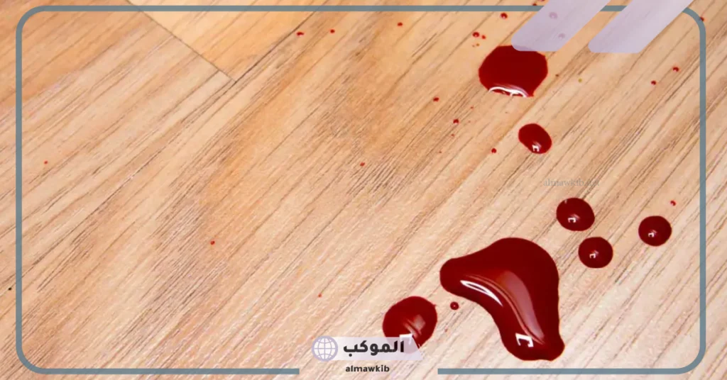 رؤية دم على الارض للرجل