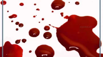 رؤية بقع الدم في المنام