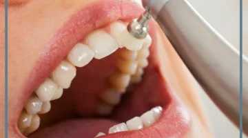 رؤية تنظيف الأسنان