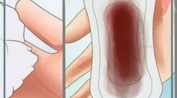 رؤية فوطة الدورة الشهرية في المنام للمتزوجة