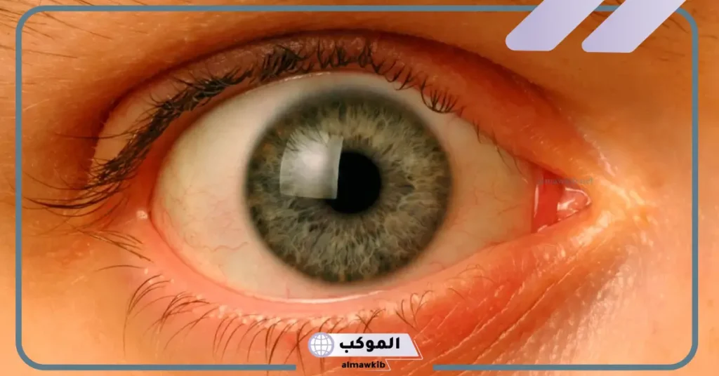 تفسير حلم العين في المنام لابن سيرين والنابلسي للمتزوجة والعزباء 6 رؤية العين البيضاء في المنام للمتزوجة