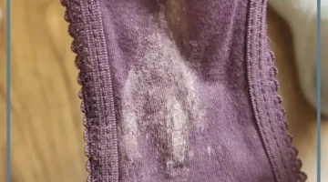 سبب نزول إفرازات مثل الماء بكثرة