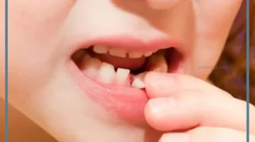 سقوط الأسنان في المنام للعزباء