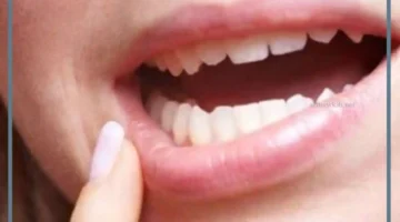 سقوط الضرس في المنام بدون دم للعزباء