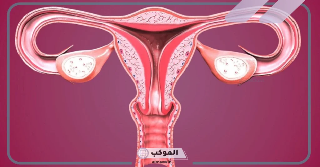 علاج انسداد الأنابيب الأعشاب