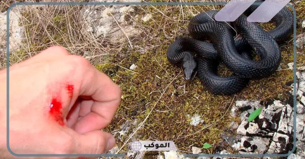 لدغة الثعبان في المنام للعزباء 