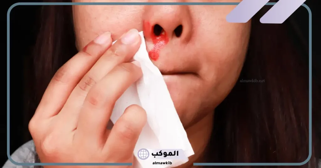 تفسير حلم نزيف الانف في المنام للرجل المتزوج والمرأة المطلقة والمتزوجة 6 تفسير نزيف الأنف في المنام للمتزوجة