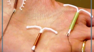 الممنوع بعد تركيب اللولب النحاسي