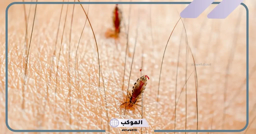 تفسير حلم القمل في المنام للمتزوجة والحامل ونزعه من الشعر 5 القمل في المنام للحامل