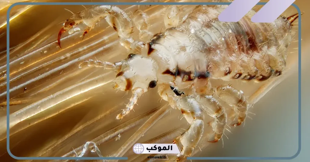 تفسير حلم القمل في المنام للمتزوجة والحامل ونزعه من الشعر 6 تفسير حلم نزع القمل من الشعر للمتزوجة