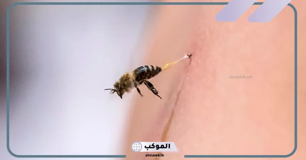 تفسير حلم قرص النحل للمتزوجة