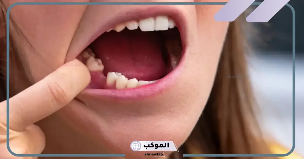 تفسير حلم سقوط الأسنان الأمامية العلوية والسفلية في المنام 6 سقوط الأسنان الأمامية في المنام للمتزوجة