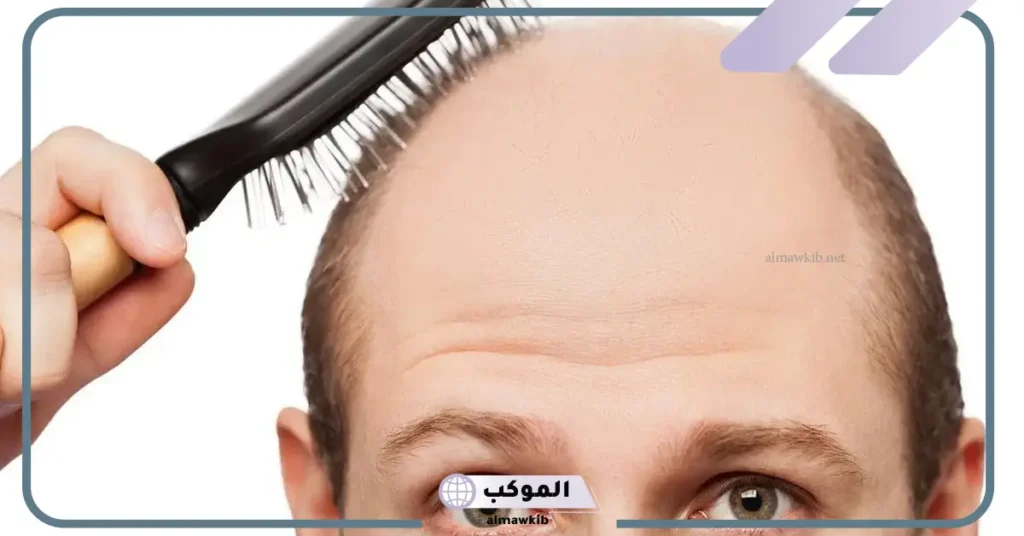 تفسير حلم الصلع في المنام للمتزوج والأعزب والمرأة لابن سيرين 5 الصلع في المنام لابن سيرين