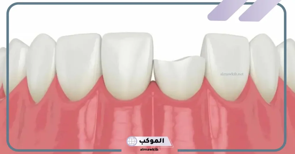 تفسير تكرار الحلم بنفس الشخص الذي تحبه للعزباء
