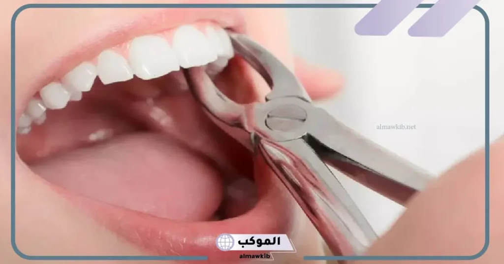 تفسير حلم خلع الضرس العلوي