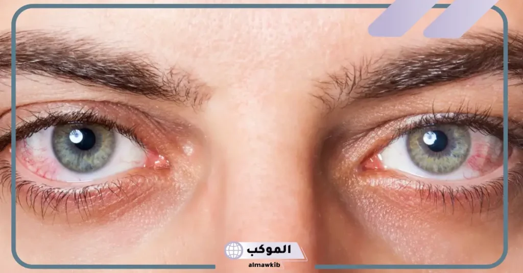 تفسير حلم العين في المنام مصابة لابن سيرين للعزباء والمتزوجة والحامل 5 تفسيرات حلم العين