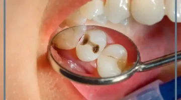 خلع الضرس في المنام