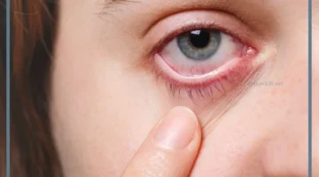 رمز حلم العين