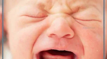 علاج مرض العظيمعند الأطفال