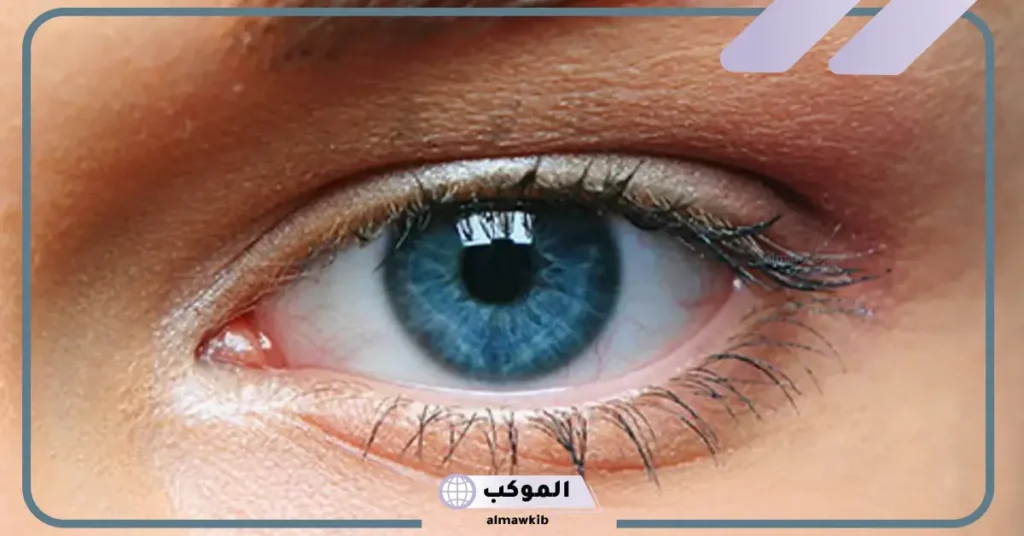 تفسير حلم العين في المنام مصابة لابن سيرين للعزباء والمتزوجة والحامل 6 وجع العين في المنام للعزباء