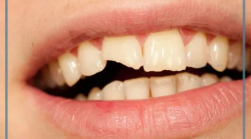 معنى سقوط السن