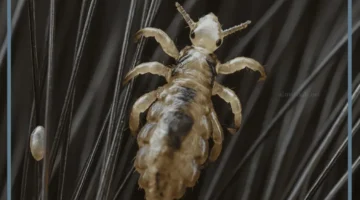 حلمت بقمل اسود