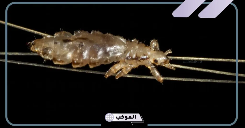 رؤية القمل في الشعر في المنام للمتزوجة