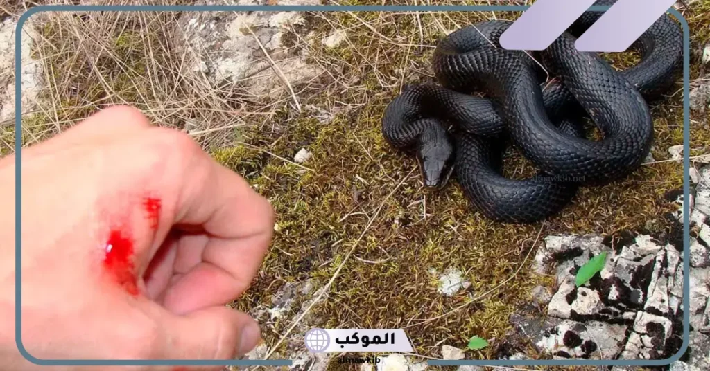 رؤية لدغة الأفعى في المنام للرجل